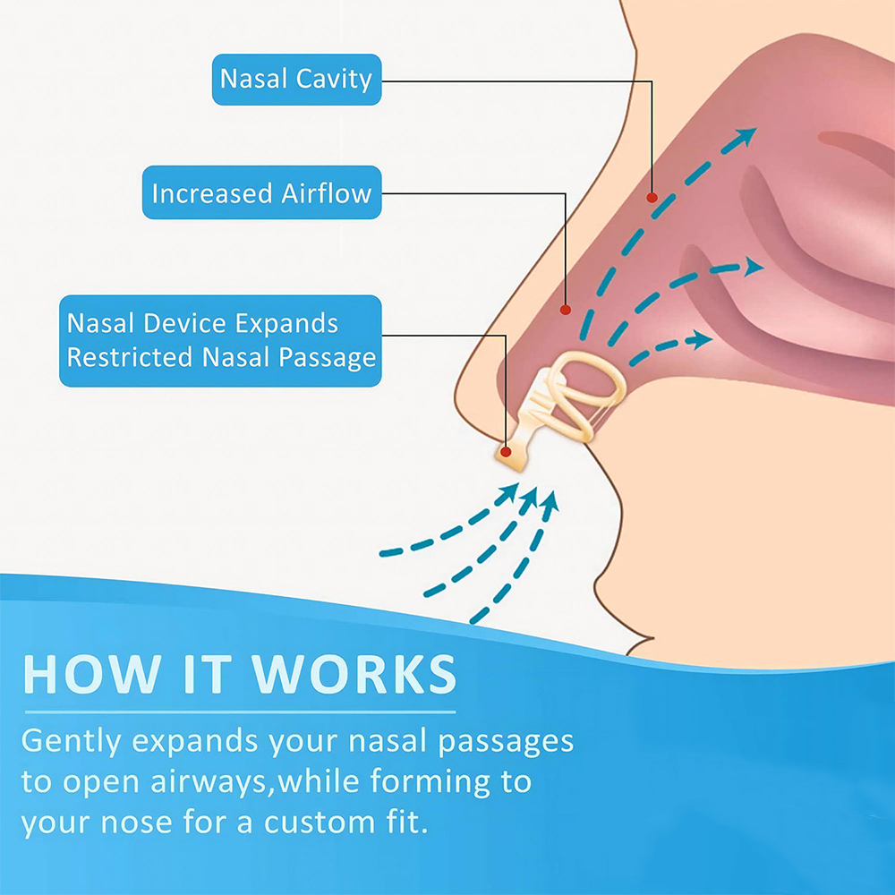 Dilatador Nasal antironquidos  - Anti Snore Contour Pillow reseña y precio